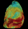 3D mechanical waves trajectory reconstruction: a new 3D ultrasound imaging [...]