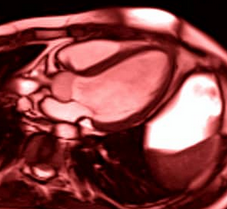 3D mechanical waves trajectory reconstruction: a new 3D ultrasound imaging [...]