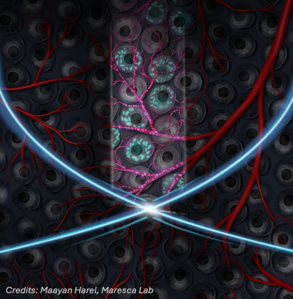 Deep Tissue Ultrasound Cellular Imaging